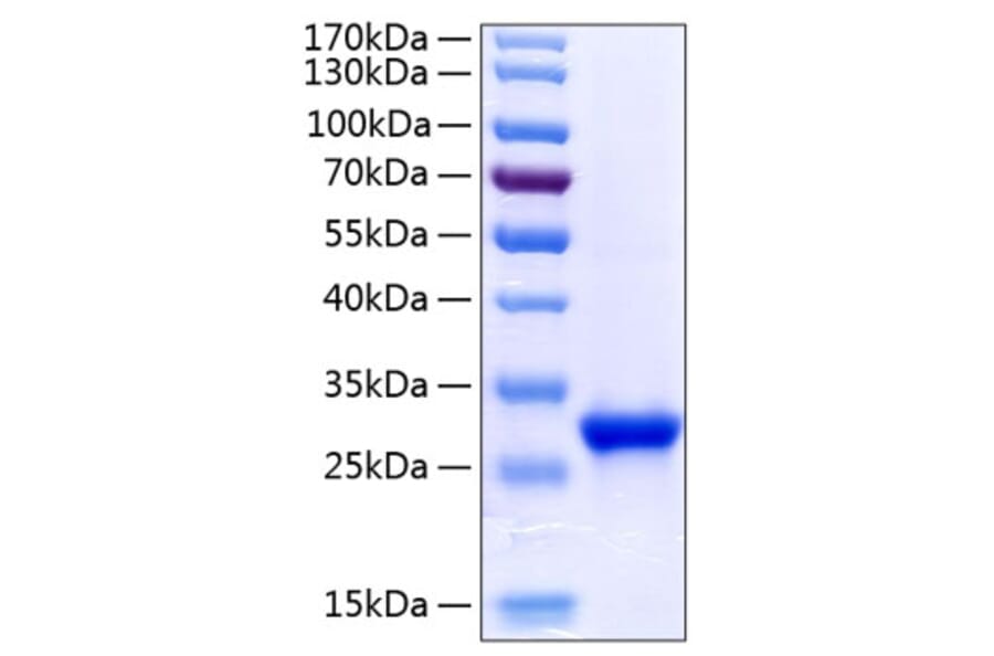 SDS-PAGE - Recombinant Human Tetranectin Protein (C-terminal His Tag) (A331307) - Antibodies.com