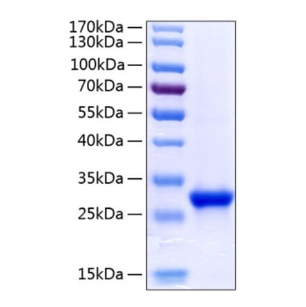 SDS-PAGE - Recombinant Human Tetranectin Protein (C-terminal His Tag) (A331307) - Antibodies.com