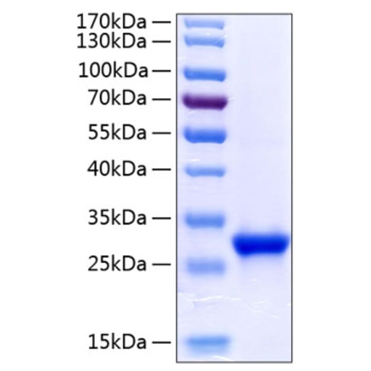 SDS-PAGE - Recombinant Human Tetranectin Protein (C-terminal His Tag) (A331307) - Antibodies.com