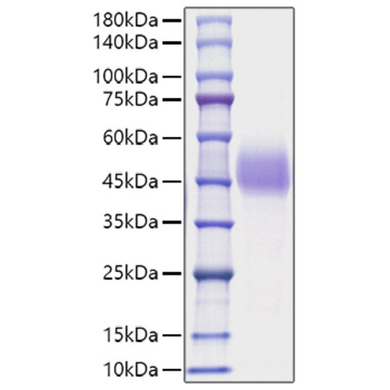 SDS-PAGE - Recombinant Mouse TFPI Protein (C-terminal His Tag) (A331308) - Antibodies.com