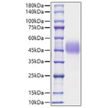 SDS-PAGE - Recombinant Mouse TFPI Protein (C-terminal His Tag) (A331308) - Antibodies.com