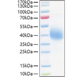 SDS-PAGE - Recombinant Human TFPI Protein (C-terminal His Tag) (A331309) - Antibodies.com