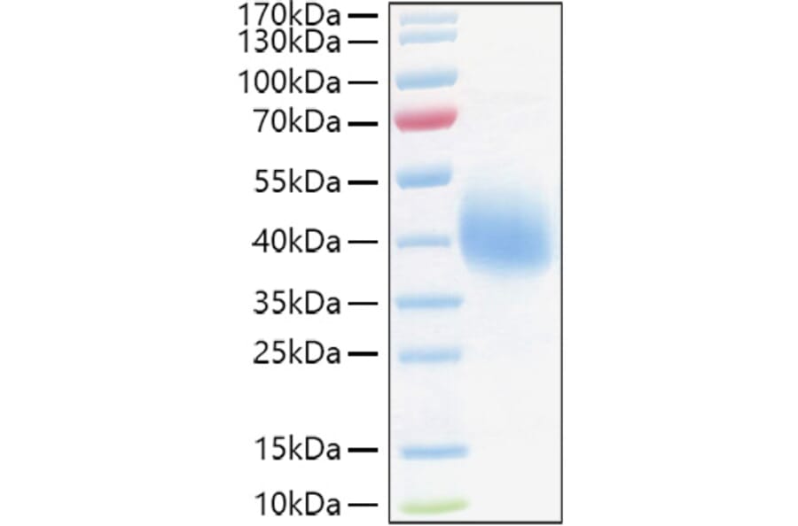 SDS-PAGE - Recombinant Human TFPI Protein (C-terminal His Tag) (A331309) - Antibodies.com