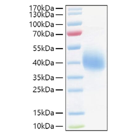 SDS-PAGE - Recombinant Human TFPI Protein (C-terminal His Tag) (A331309) - Antibodies.com
