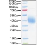 SDS-PAGE - Recombinant Human TFPI Protein (C-terminal His Tag) (A331309) - Antibodies.com