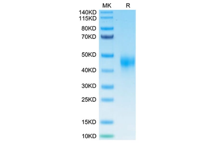Tris-Bis PAGE - Recombinant Human TFPI Protein (Biotin) (C-terminal His and Avi Tag) (A331310) - Antibodies.com