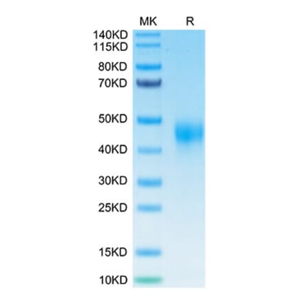 Tris-Bis PAGE - Recombinant Human TFPI Protein (Biotin) (C-terminal His and Avi Tag) (A331310) - Antibodies.com