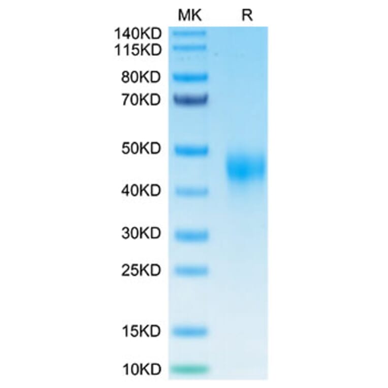 Tris-Bis PAGE - Recombinant Human TFPI Protein (Biotin) (C-terminal His and Avi Tag) (A331310) - Antibodies.com