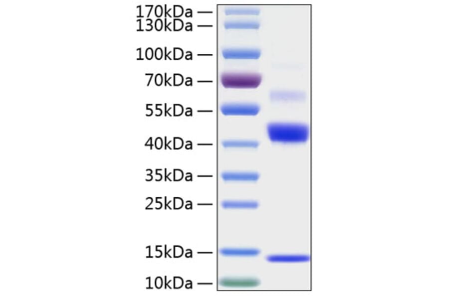 SDS-PAGE - Recombinant Human TGF beta 1 Protein (N-terminal His Tag) (A331312) - Antibodies.com