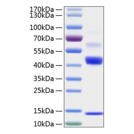 SDS-PAGE - Recombinant Human TGF beta 1 Protein (N-terminal His Tag) (A331312) - Antibodies.com