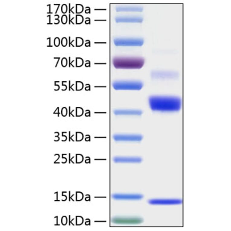 SDS-PAGE - Recombinant Human TGF beta 1 Protein (N-terminal His Tag) (A331312) - Antibodies.com