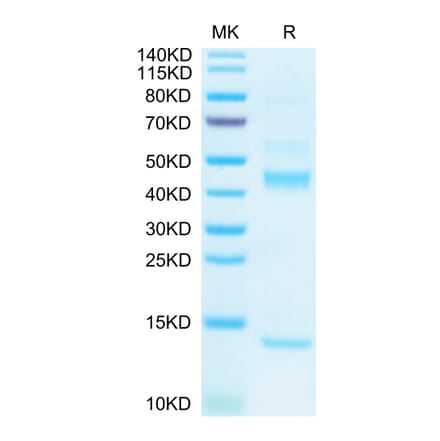 Tris-Bis PAGE - Recombinant Human TGF beta 1 Protein (Biotin) (N-terminal His and Avi Tag) (A331314) - Antibodies.com