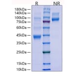 SDS-PAGE - Recombinant Human TGF beta 1 Protein (N-terminal His Tag) (A331315) - Antibodies.com