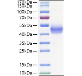 SDS-PAGE - Recombinant Human TGF beta Receptor I Protein (C-terminal Human Fc and His Tag) (A331318) - Antibodies.com