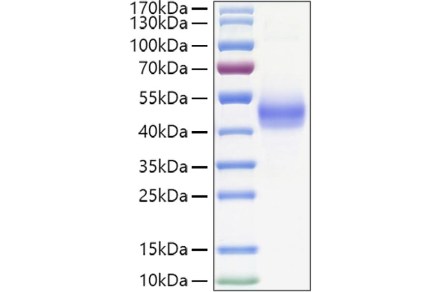 SDS-PAGE - Recombinant Human TGF beta Receptor I Protein (C-terminal Human Fc and His Tag) (A331318) - Antibodies.com