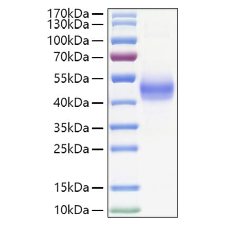 SDS-PAGE - Recombinant Human TGF beta Receptor I Protein (C-terminal Human Fc and His Tag) (A331318) - Antibodies.com
