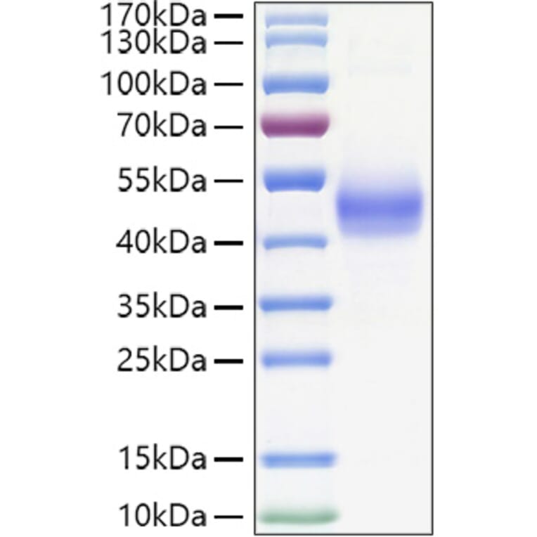 SDS-PAGE - Recombinant Human TGF beta Receptor I Protein (C-terminal Human Fc and His Tag) (A331318) - Antibodies.com