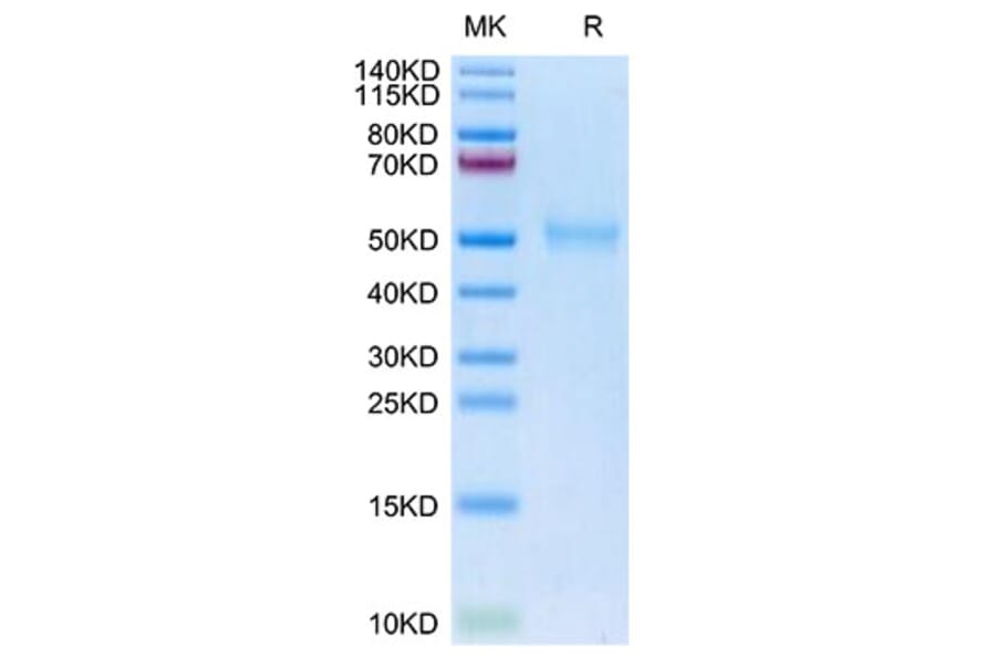 Tris-Bis PAGE - Recombinant Human TGF beta Receptor I Protein (Biotin) (C-terminal His and Avi Tag) (A331319) - Antibodies.com