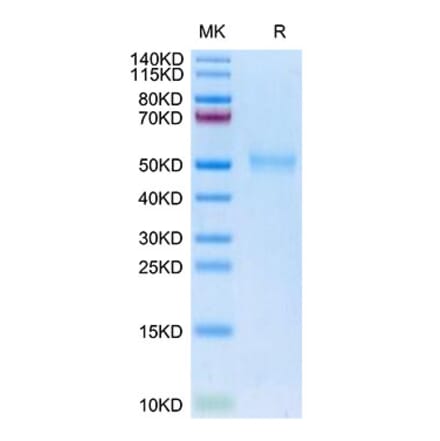 Tris-Bis PAGE - Recombinant Human TGF beta Receptor I Protein (Biotin) (C-terminal His and Avi Tag) (A331319) - Antibodies.com