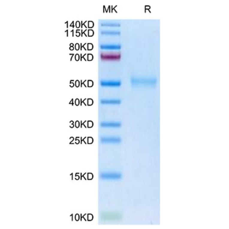 Tris-Bis PAGE - Recombinant Human TGF beta Receptor I Protein (Biotin) (C-terminal His and Avi Tag) (A331319) - Antibodies.com