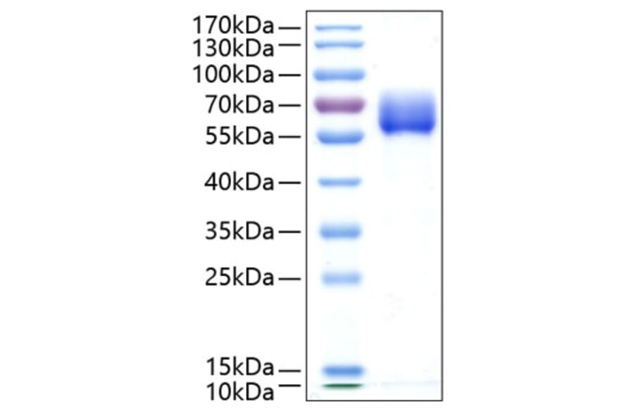 SDS-PAGE - Recombinant Human TGF beta Receptor II Protein (C-terminal Human Fc and His Tag) (A331320) - Antibodies.com