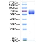 SDS-PAGE - Recombinant Human TGF beta Receptor II Protein (C-terminal Human Fc and His Tag) (A331320) - Antibodies.com