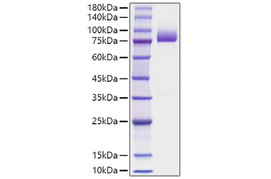 SDS-PAGE - Recombinant human Thrombin Protein (C-terminal His Tag) (A331322) - Antibodies.com