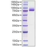 SDS-PAGE - Recombinant human Thrombin Protein (C-terminal His Tag) (A331322) - Antibodies.com