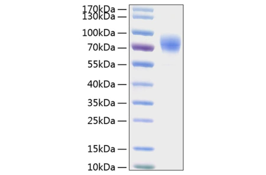 SDS-PAGE - Recombinant Human Thrombopoietin Protein (C-terminal His Tag) (A331323) - Antibodies.com