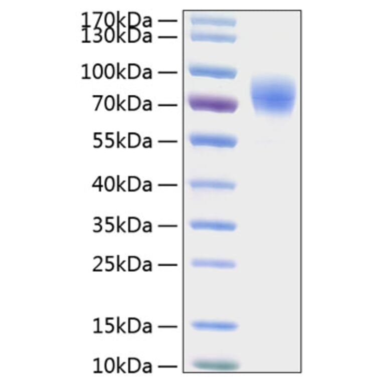 SDS-PAGE - Recombinant Human Thrombopoietin Protein (C-terminal His Tag) (A331323) - Antibodies.com