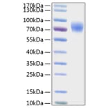 SDS-PAGE - Recombinant Human Thrombopoietin Protein (C-terminal His Tag) (A331323) - Antibodies.com