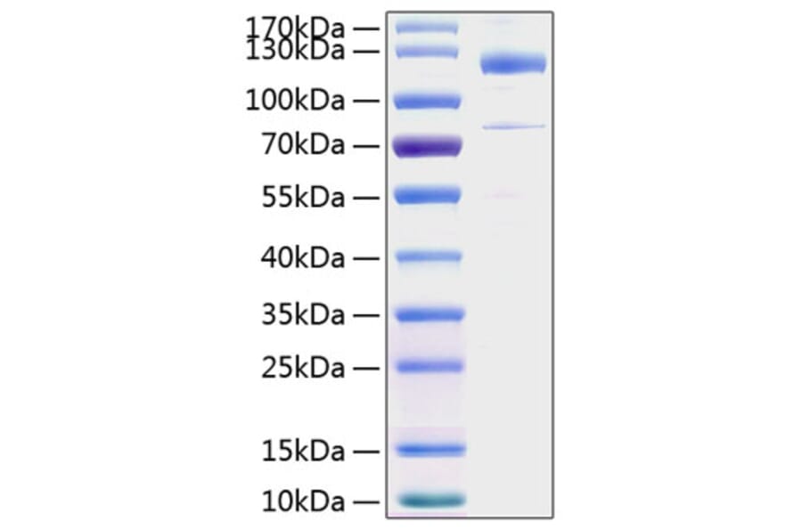 SDS-PAGE - Recombinant Human Thrombospondin 1 Protein (C-terminal His Tag) (A331324) - Antibodies.com