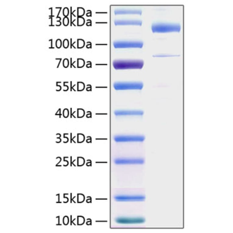 SDS-PAGE - Recombinant Human Thrombospondin 1 Protein (C-terminal His Tag) (A331324) - Antibodies.com
