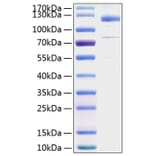 SDS-PAGE - Recombinant Human Thrombospondin 1 Protein (C-terminal His Tag) (A331324) - Antibodies.com
