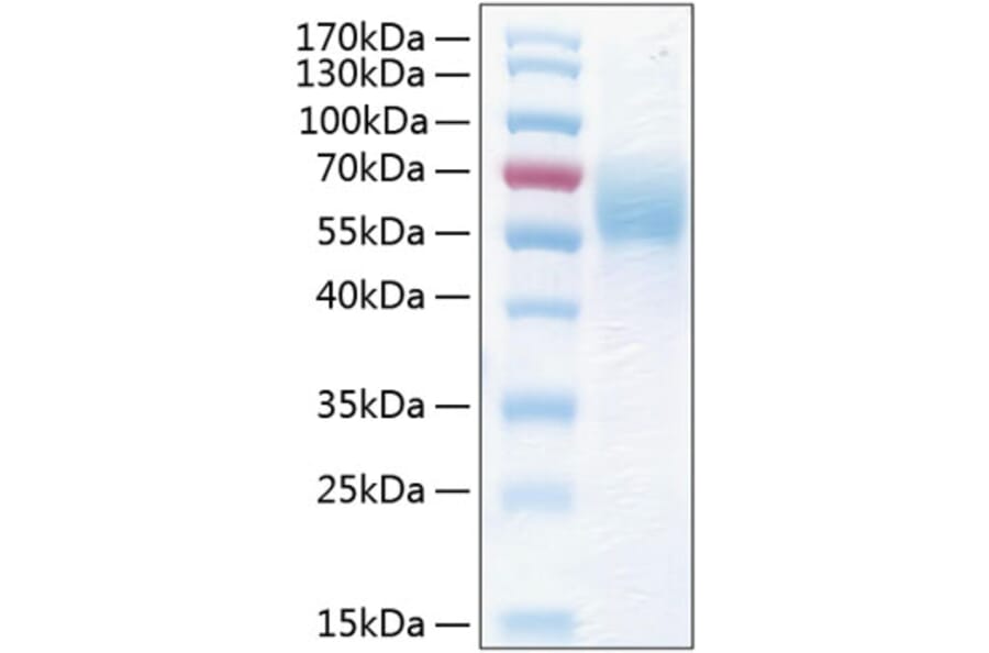 SDS-PAGE - Recombinant Human THSD1 Protein (C-terminal His Tag) (A331325) - Antibodies.com