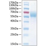 SDS-PAGE - Recombinant Human THSD1 Protein (C-terminal His Tag) (A331325) - Antibodies.com