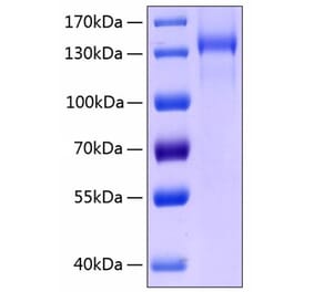 SDS-PAGE - Recombinant Human Tie2 Protein (C-terminal Human Fc and His Tag) (A331326) - Antibodies.com