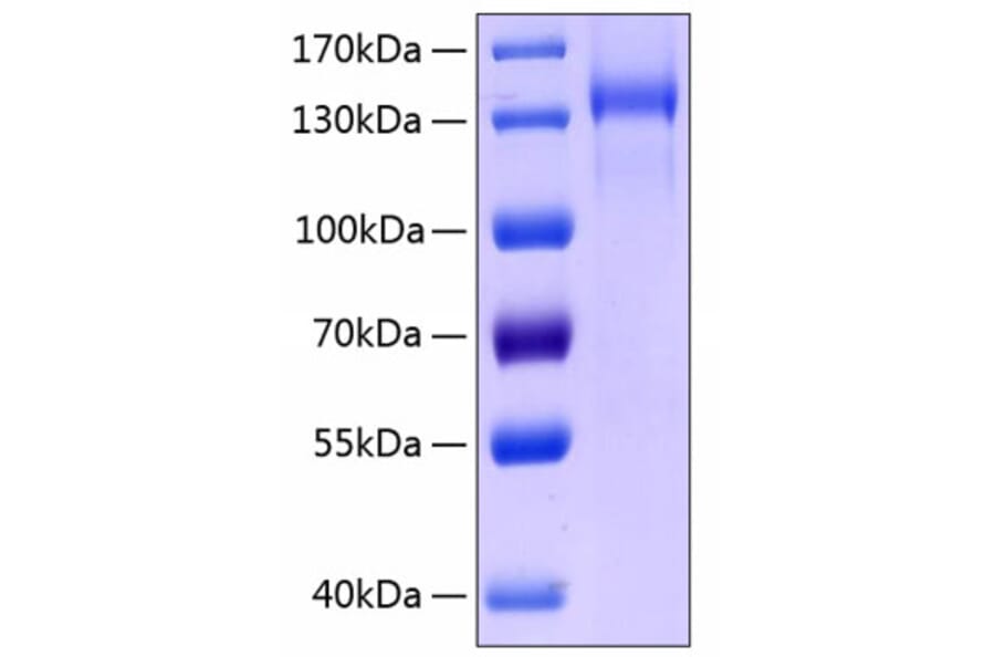 SDS-PAGE - Recombinant Human Tie2 Protein (C-terminal Human Fc and His Tag) (A331326) - Antibodies.com