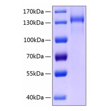 SDS-PAGE - Recombinant Human Tie2 Protein (C-terminal Human Fc and His Tag) (A331326) - Antibodies.com