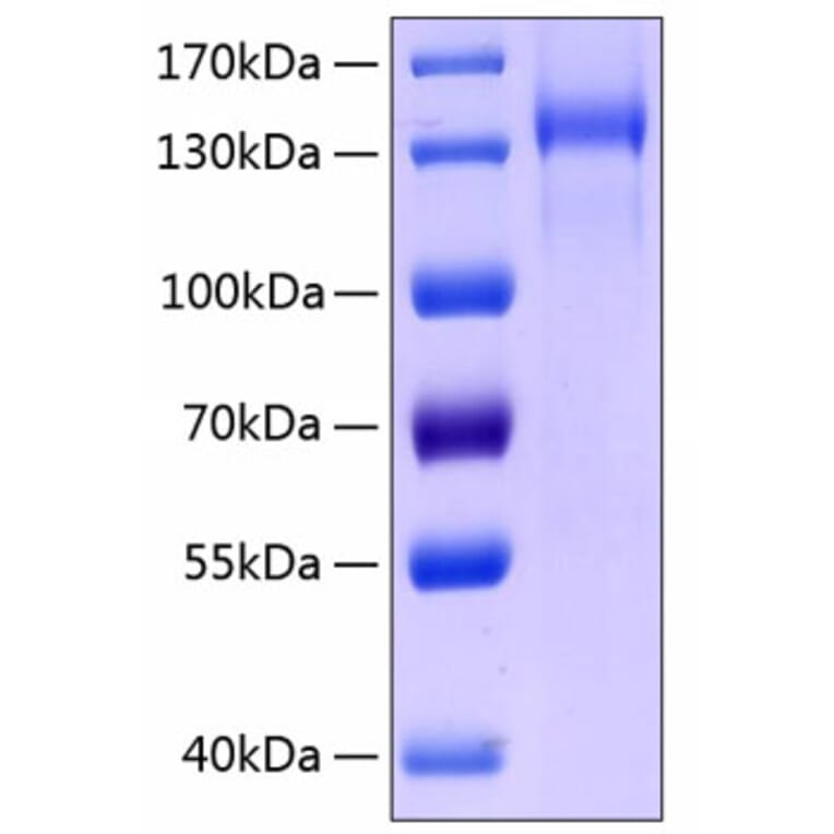 SDS-PAGE - Recombinant Human Tie2 Protein (C-terminal Human Fc and His Tag) (A331326) - Antibodies.com