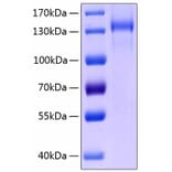 SDS-PAGE - Recombinant Human Tie2 Protein (C-terminal Human Fc and His Tag) (A331326) - Antibodies.com