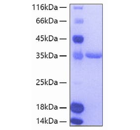 SDS-PAGE - Recombinant Human Tie2 Protein (A331327) - Antibodies.com