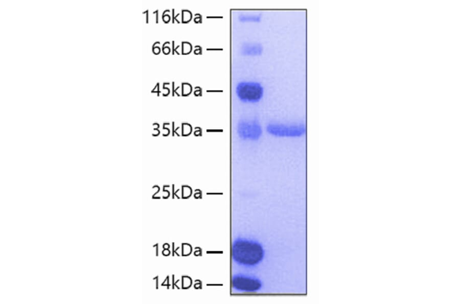 SDS-PAGE - Recombinant Human Tie2 Protein (A331327) - Antibodies.com