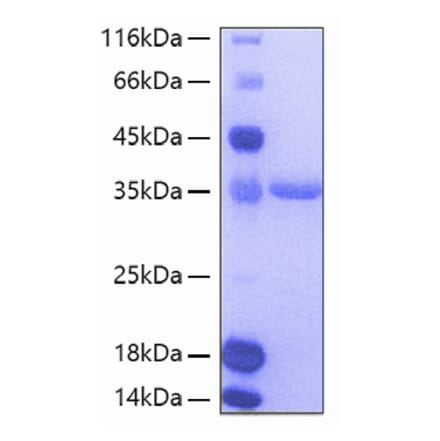 SDS-PAGE - Recombinant Human Tie2 Protein (A331327) - Antibodies.com