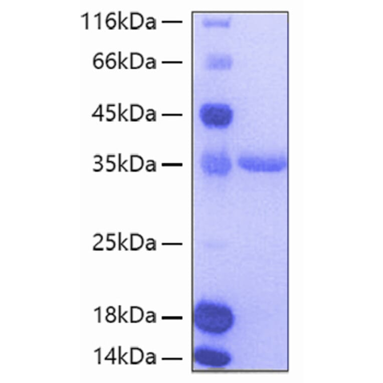 SDS-PAGE - Recombinant Human Tie2 Protein (A331327) - Antibodies.com