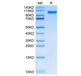 Tris-Bis PAGE - Recombinant Human Tie2 Protein (C-terminal His Tag) (A331328) - Antibodies.com