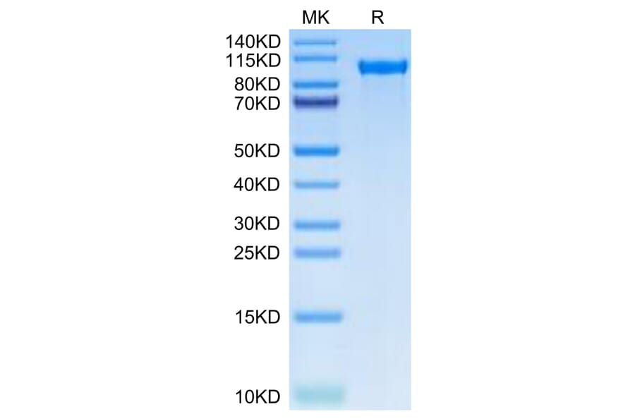 Tris-Bis PAGE - Recombinant Human Tie2 Protein (C-terminal His Tag) (A331328) - Antibodies.com