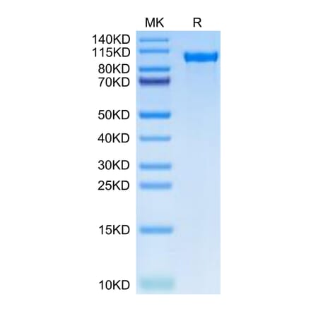Tris-Bis PAGE - Recombinant Human Tie2 Protein (C-terminal His Tag) (A331328) - Antibodies.com