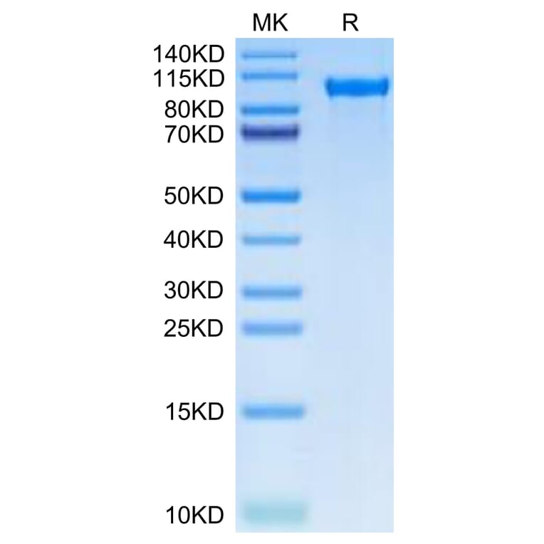 Tris-Bis PAGE - Recombinant Human Tie2 Protein (C-terminal His Tag) (A331328) - Antibodies.com