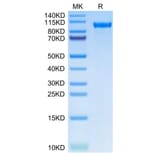 Tris-Bis PAGE - Recombinant Human Tie2 Protein (C-terminal His Tag) (A331328) - Antibodies.com